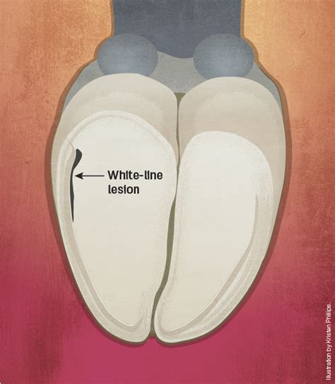 Don’t cross the line when managing white-line disease - Progressive Dairy | Ag Proud