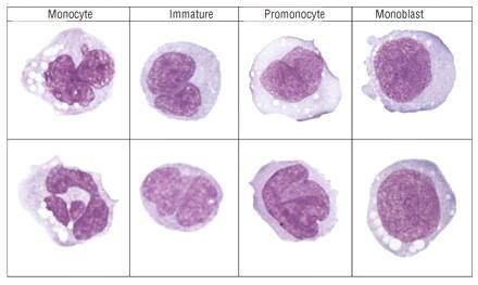 Monocyte morphology and maturation | Medical Laboratories