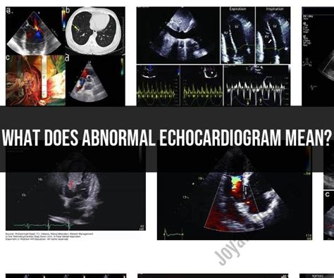 Understanding Abnormal Echocardiogram Results: Medical Insights - JoyAnswer.org