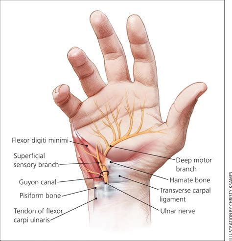 Evaluation and Diagnosis of Wrist Pain: A Case-Based Approach ...