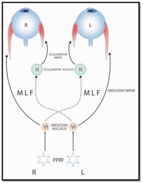 Medial Longitudinal Fasciculus Pons