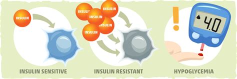 Insulin Sensitivity Complete Guide [What Is It & How to Optimize]