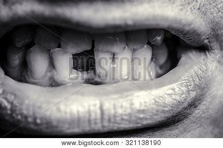 No Teeth. Smile Men Image & Photo (Free Trial) | Bigstock