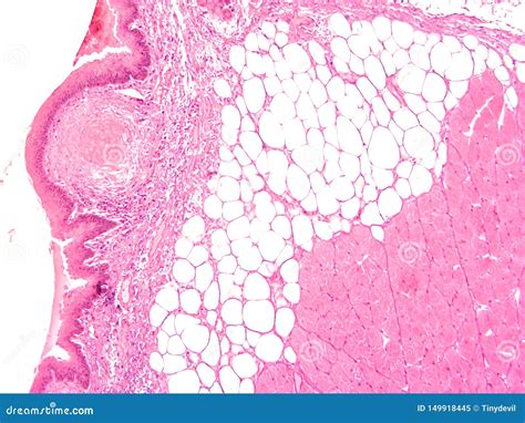 Histology of Human Larynx Tissue Stock Image - Image of cuboidal ...