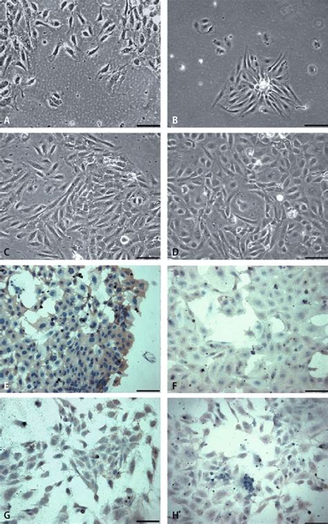 Morphology and immunophenotyping of endothelial cells. HUVEC (a, c) and ...