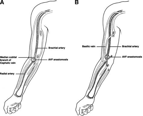 Basilic Vein Anatomy