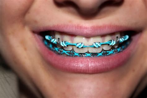 Pin on Lip art