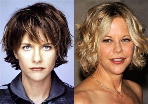 Meg Ryan before and after plastic surgery (22) – Celebrity plastic surgery online