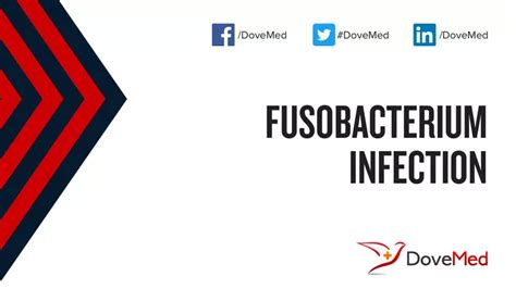 Fusobacterium Infection - DoveMed