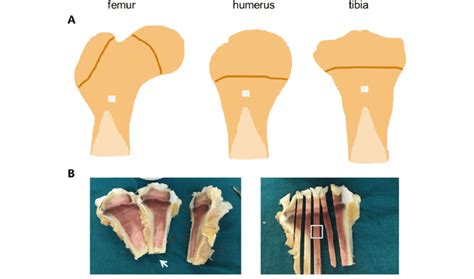 (A) Regions in the proximal metaphysis of the femur, humerus, and tibia... | Download Scientific ...