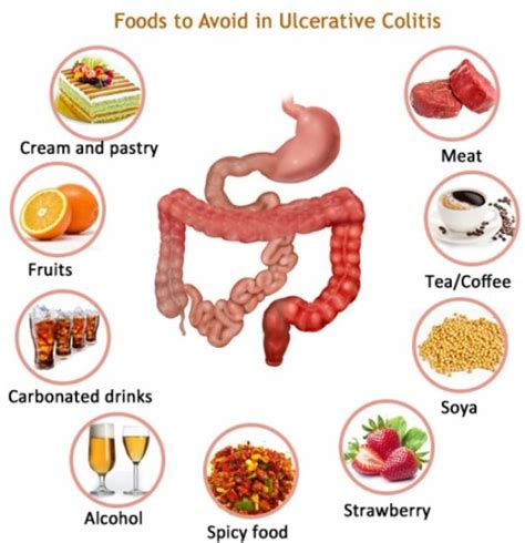 Foods To Avoid With Ulcerative Colitis - Theayurveda