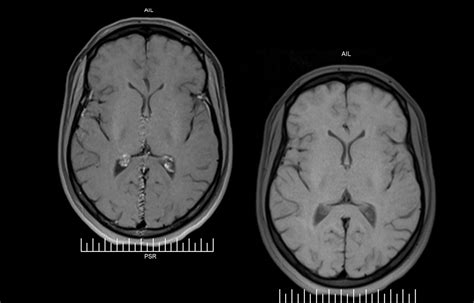 Dubai Neuro Radiology Center/ MRI-CT Scan