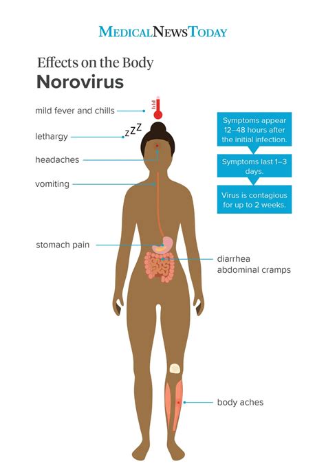 Norovirus: Symptoms, treatment, and prevention