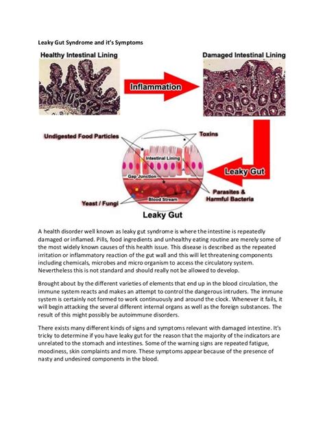 Leaky gut syndrome treatment