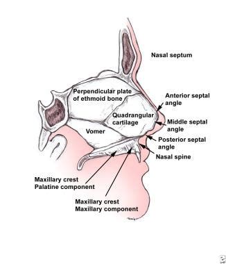 Nasal and Septal Fractures: Practice Essentials, Epidemiology, Etiology