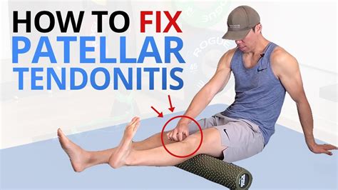 Why Common Patellar Tendonitis Rehab FAILS and 5 exercises that WORK! – FastestWellness