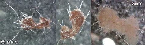 Morgellons microscopic pictures photos of unnown fungus fibers gmo pics