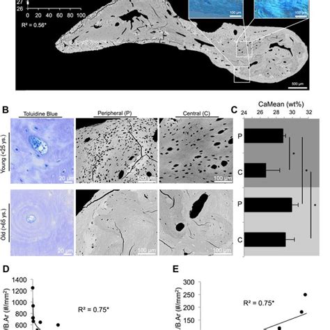 Osteocyte canalicular connections and apoptosis. (1.-3.) Diagrams... | Download Scientific Diagram