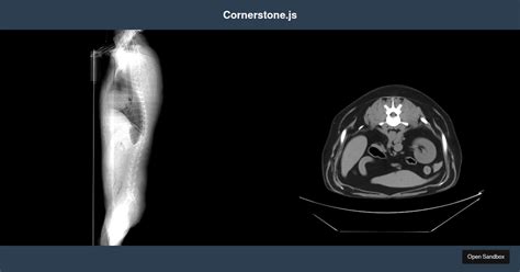 cornerstone-wado-image-loader examples - CodeSandbox