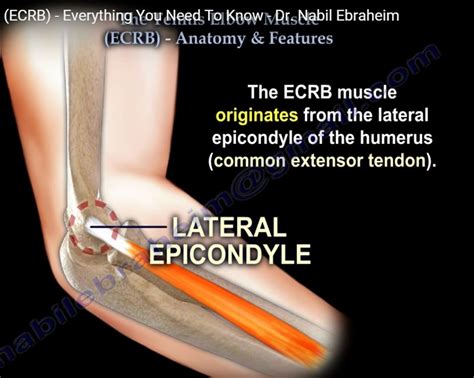 Tennis Elbow and the ECRB Tendon — OrthopaedicPrinciples.com