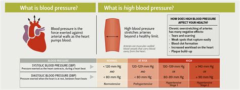 What Is A High Systolic Blood Pressure Deals Sale, Save 44% | jlcatj.gob.mx