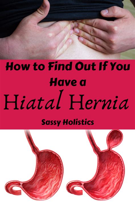 Hiatal Hernia- A Hidden Cause of MANY Symptoms! | Migraines remedies ...