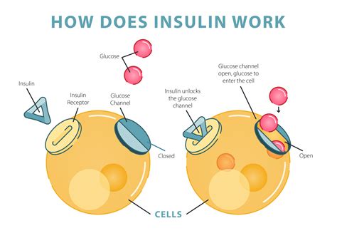 For Kids: What is Diabetes? - Children with Diabetes