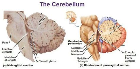 Pictures Of Cerebellar Peduncles