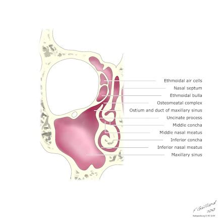 Ostium Of Maxillary Sinus