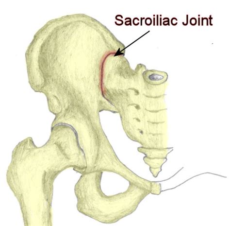 Inspirational letters by Millie: Inflammed Sacroiliac Joint