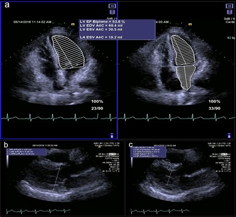 Cardiol Res