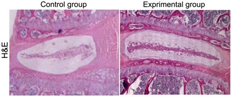 Annulus Fibrosus Histology