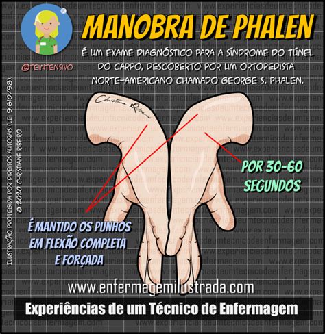 Manobra de Phalen | Enfermagem Ilustrada