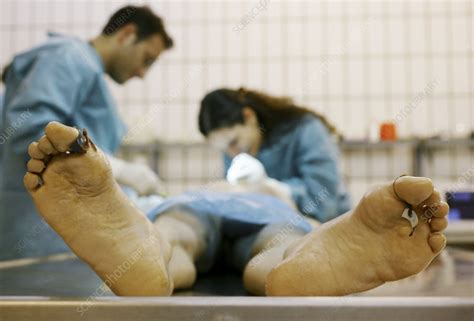 Autopsy examination - Stock Image - M876/0097 - Science Photo Library