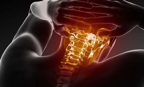 Broken Neck: X-Ray Diagnosis and Treatment | El Paso's Injury Doctors® 915-850-0900