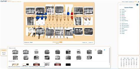 Curve Dental EHR Software | Free Demo, Pricing & Reviews 2024 | EMRFinder