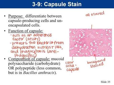 Lab 3-9: Capsule Stain - YouTube