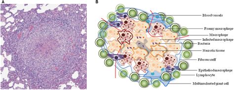 Frontiers | Modeling the Mycobacterium tuberculosis Granuloma – the Critical Battlefield in Host ...