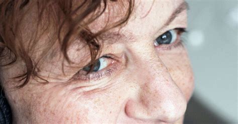 Heavy Eyelids: Causes and Home Remedies