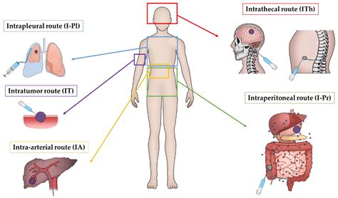 Pharmaceutics | Free Full-Text | Anatomical Targeting of Anticancer Drugs to Solid Tumors Using ...