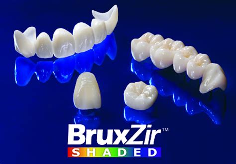 BruxZir Shaded by Glidewell Laboratories | Dentistry IQ