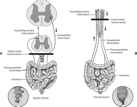 Upper Motor Neuron Pathway