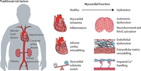 Predicting and preventing heart failure in type 2 diabetes - The Lancet ...