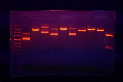 Como a eletroforese em gel separa fragmentos de DNA - 2022 - Notícia