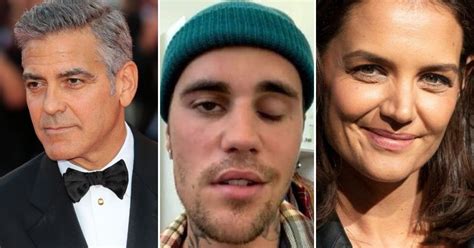 Justin Bieber paralysé : 6 célébrités aussi atteintes d’une paralysie du visage