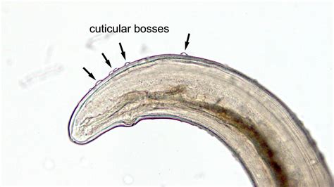 Pathology Outlines - Dirofilaria repens