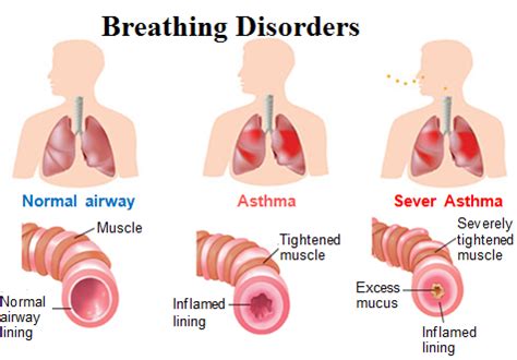 Abnormal Breathing and Breathing Disorders: - Karuna Yoga-Best Yoga ...