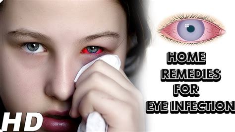 Home Remedies For Eye Infectionzip Eye Infections