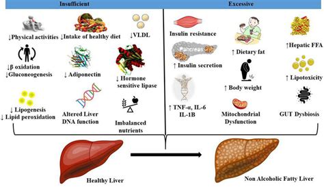 Functional Foods for the Management of Non-Alcoholic Fatty Liver ...