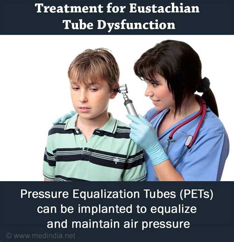 Retracted Eardrum Eustachian Tube Dysfunction